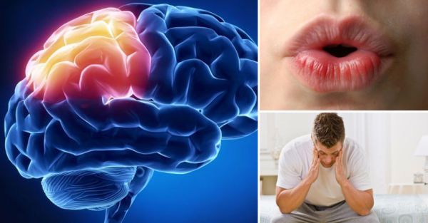 ¿ Como detectar un ACV ?