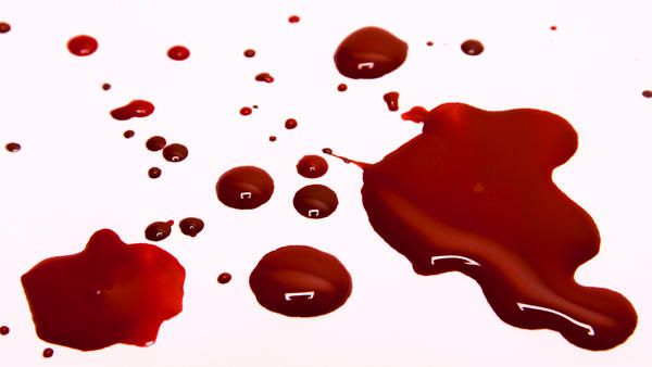 las-personas-con-el-tipo-de-sangre-o-podrian-tener-mas-riesgo-de-morir-por-una-herida-grave_reference.jpg